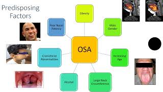 Obstructive Sleep Apnea for beginners [upl. by Piegari614]