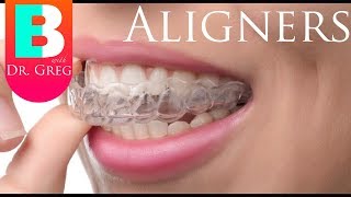 Things to Know Before Invisalign  Clear Aligner Therapy [upl. by Volotta]