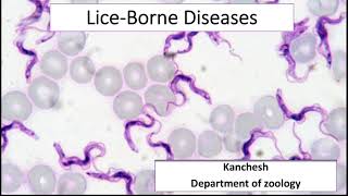 Liceborne diseases Trench Fever Relapsing Fever and Epidemic typhus [upl. by Grady]