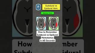 🔥 How to Remember Subdural vs Epidural Hematomas in 60 Seconds Nursing [upl. by Neelhtak892]