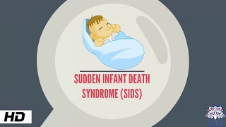 Sudden Infant Death syndrome Causes and Prevention [upl. by Carlyn]