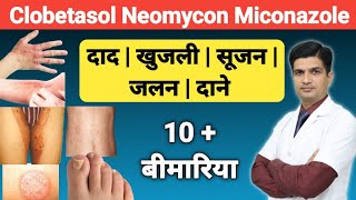 दाद खुजली को ठीक करने की क्रीम । Clobetasol Neomycin and Miconazole cream [upl. by Narbig]