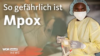 Mpox WHO ruft weltweite Notlage aus  WDR Aktuelle Stunde [upl. by Dnomyaw]