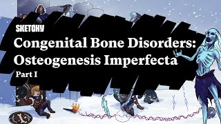 Congenital Bone Disorders Osteogenesis Imperfecta Part 1 of 2  Sketchy Medical  USMLE Step 1 [upl. by Luhey215]