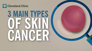 3 Types of Skin Cancer [upl. by Asnarepse366]