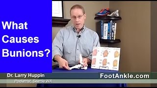 What Causes Bunions  Seattle Podiatrist Dr Larry Huppin [upl. by Etac]