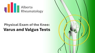 KNEE exam Varus and Valgus Tests for MCL and LCL laxity [upl. by Ob]