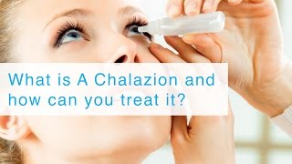 What is A Chalazion and how can you treat it [upl. by Amandie]