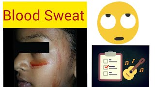 Hematidrosis  blood sweat  bloody sweat  learn with fun  bleeding from skin [upl. by Aihsema]