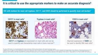 Systemic Mastocytosis Overview of Disease and Diagnosis for Pathologists [upl. by Saloma683]