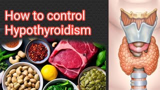 How to control Hypothyroid Thyroid selfcare and wellness [upl. by Sivia532]