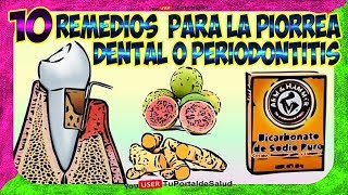 10 Remedios Caseros para la Piorrea Dental o Periodontitis  Como Tratar Curar Periodontitis🚩🚩 [upl. by Mahtal]