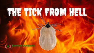 TICK BITE Case Study Ehrlichia Chaffeensis [upl. by Langham]