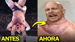 Lesiones Que Cambiaron Permanentemente El Cuerpo De Los Luchadores De La WWE [upl. by Aner]