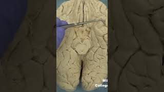 Temporal and occipitotemporal areas of cortexneuroanatomy brainanatomy [upl. by Arait]