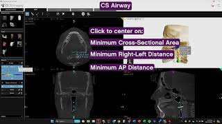 CS Airway Quick Demo [upl. by Seek324]