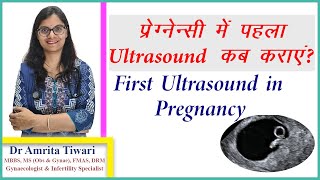 Pregnancy mein pahla Ultrasound kab karaein  First USG in Pregnancy [upl. by Freyah]