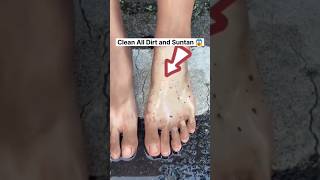 🔥Get Fair Feet  Easy Suntan Removal Pack At Home RemoveSuntan shortsytshortssuntandiyviral [upl. by Nnep113]