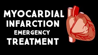 Myocardial Infarction MIHeart Attack Treatment in Emergency  Step wise STEMI Management USMLE [upl. by Wallraff]