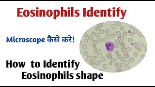 How to identify eosinophils I how to identify wbc in microscope [upl. by Etteiram132]