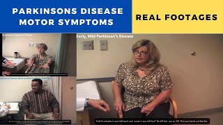 Parkinsons Disease Motor Symptoms  Real Fooatages [upl. by Petracca]