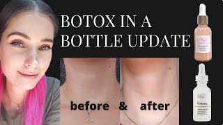 Update Botox In A Bottle  The Ordinary 10 Argireline amp Pink skincare 10 Argireline 10 Matrixyl [upl. by Sachs621]