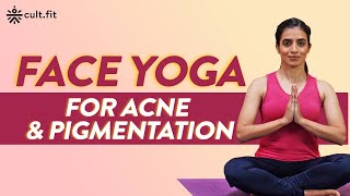 Face Yoga For Acne And Pigmentation  Face Yoga For Youthful Skin  Face Yoga Workout  CultFit [upl. by Clementas]