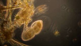 Protozoa Ciliate Division by Equal Binary Fission in HD [upl. by Eirrod]