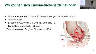 Vortrag quotEndometriose im Fokusquot mit Ärztinnen unserer Frauenklinik Spital Zollikerberg [upl. by Adlemi]