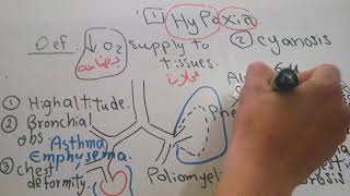 Respiratory new system Hypoxia and Cyanosis dr mohamed fayez [upl. by Jairia677]