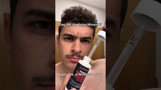 Minoxidil for MAX Beard Growth [upl. by Ianteen]