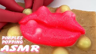 Unwind with a Pimple Popping Livestream on Realistic Silicone Models  Stress Relief Therapy [upl. by Ecyarg]