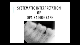 Systematic interpretation of IOPA radiograph [upl. by Htaeh]