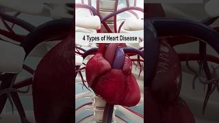 4 Types of Heart Disease hearthealth heartattack heart [upl. by Atram188]