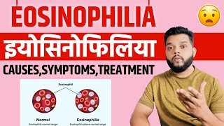 Eosinophilia Causes Symptoms amp Treatment In Hindi [upl. by Aitsirhc]