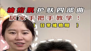 油痘肌痘痘干掉以后，教会你后续怎么护肤维稳不长闭口 [upl. by Gottfried]