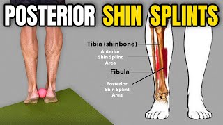 3 Rehab Exercises for Posterior Shin Splints [upl. by Stepha]