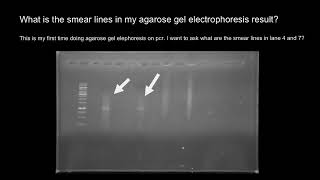 What causing DNA smear on agarose gel [upl. by Mishaan]