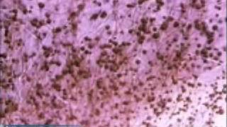 Penicillium Mold Growth [upl. by Arayk]