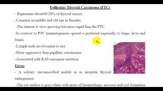 Follicular Thyroid Carcinoma FTC [upl. by Kirimia392]