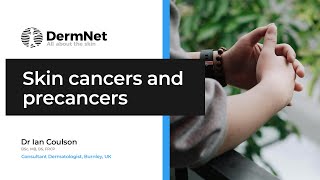 Skin cancers and precancers essentials [upl. by Inoek]