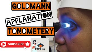 Goldmann Applanation Tonometer  Tonometry [upl. by Demahom]