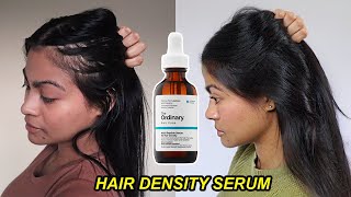 I tried The Ordinary Hair Density Serum for 1 YEAR amp THIS HAPPENED  Before and after results [upl. by Nilahs]