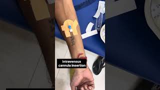 IV Cannula Technique Training nurses medicalprocedure cannulainsertion bscnursingytshortsvideo [upl. by Eigroeg]