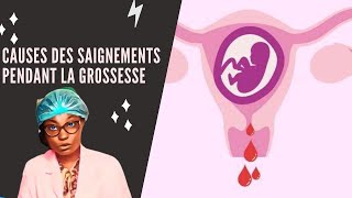 Causes des saignements pendant la grossesse [upl. by Tiler]