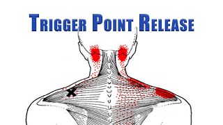 Trigger Point Release  Upper Trapezius Levator Scapulae and Suboccipitals  No Tools Needed [upl. by Wendelin81]