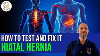 How To Test For Hiatal Hernia and Fix It [upl. by Stephine]