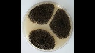 Aspergillus niger growth on SDA and its structures in LPCB mount [upl. by Aunson281]