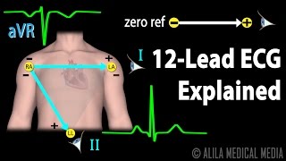 12 Lead ECG Explained Animation [upl. by Netloc]