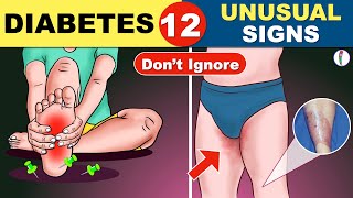 12 Unusual Symptoms of Diabetes  Diabetes Symptoms  Diabetes Mellitus   Diabetes Warning Signs [upl. by Fawna]